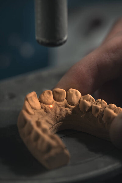 Dental Prosthesis / Artificial Tooth