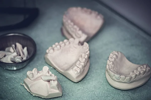 Laboratorio de prótesis dental — Foto de Stock