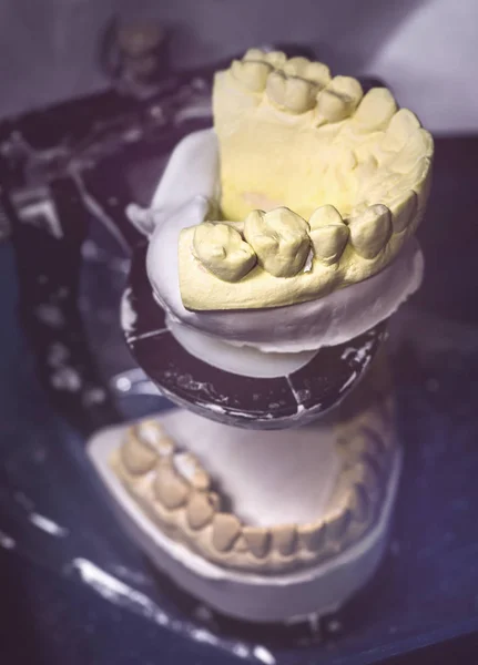 Laboratorio de prótesis dental — Foto de Stock