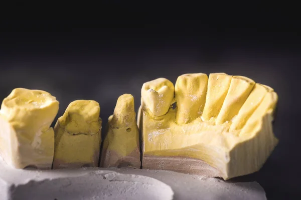 Prótese dentária Laboratório de prótese — Fotografia de Stock