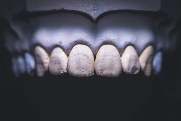 義歯補綴研究所 — ストック写真
