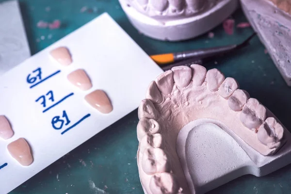 Prótese dentária Laboratório de prótese — Fotografia de Stock