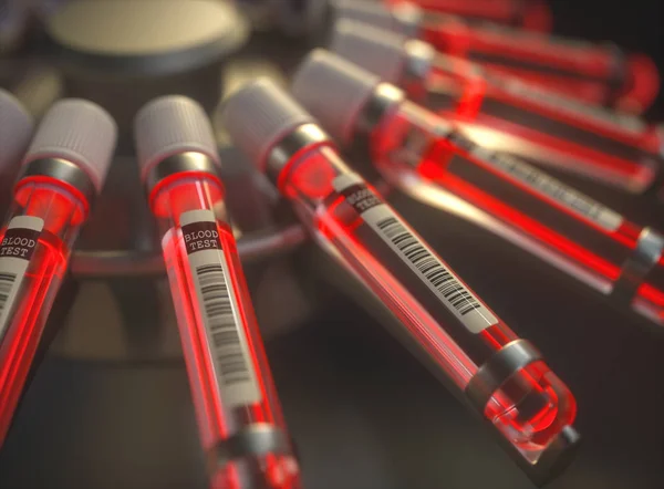 화학 시험 밝은 빨간 혈액 — 스톡 사진