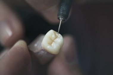Diş Protez Laboratuvarı bakım Toot