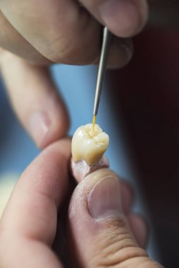 Diş Protez Laboratuvarı bakım Toot
