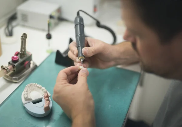 Prótesis Dental Cuidado de Laboratorio Toot —  Fotos de Stock