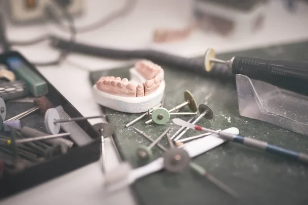 Prótese dentária Laboratório Cuidados Toot — Fotografia de Stock