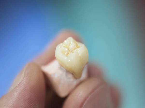 Prótese dentária Laboratório Cuidados Toot — Fotografia de Stock