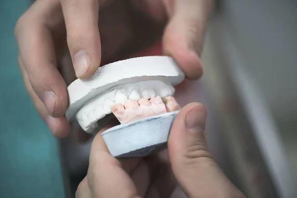 Prótese dentária Laboratório Cuidados Toot — Fotografia de Stock