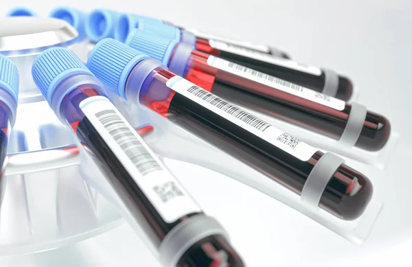 Blood Tubes Laboratory Tests Genetic Research — 스톡 사진