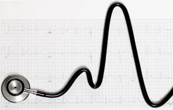 Stethoskop in Form von Herzschlag auf Elektrokardiogramm. — Stockfoto
