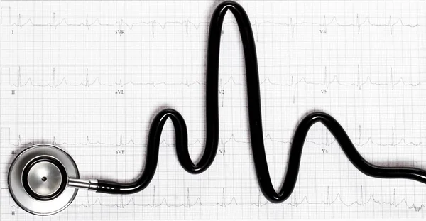 Στηθοσκόπιο σε σχήμα καρδιά κτύπησε στο ηλεκτροκαρδιογράφημα. — Φωτογραφία Αρχείου
