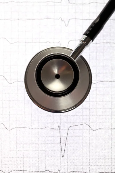 Vue rapprochée du stéthoscope sur fond d'électrocardiogramme . — Photo