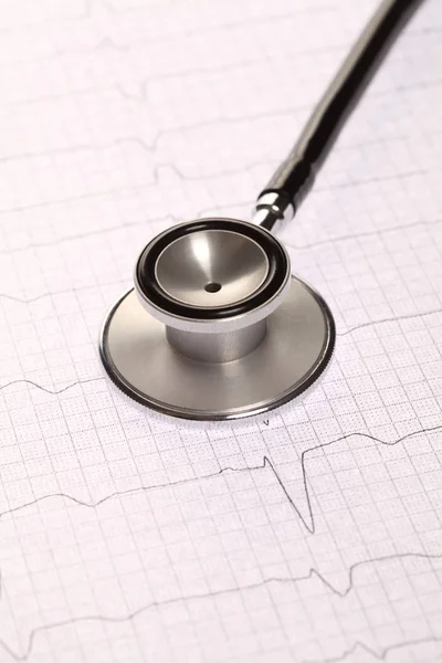Nahaufnahme des Stethoskops auf dem Hintergrund des Elektrokardiogramms. — Stockfoto