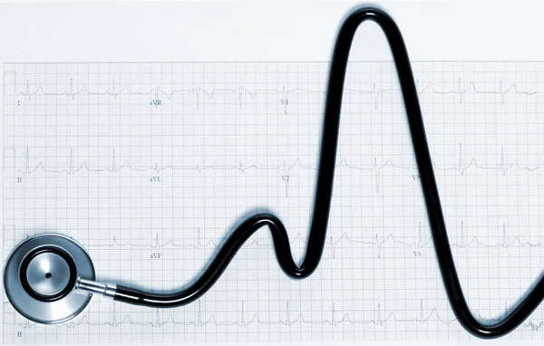 Stetoscopio a forma di battito cardiaco su elettrocardiogramma. Tinto in blu . — Foto Stock
