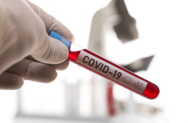 Coronavirus tarafından kirletilmiş biyolojik bir tüp ile mikrobiyolog beyaz arka planda Covid-19 etiketiyle