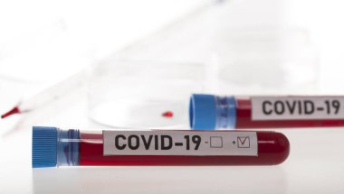Coronavirus tarafından kirletilmiş biyolojik örnek tüpleri beyaz arka planda Covid-19 etiketi ile