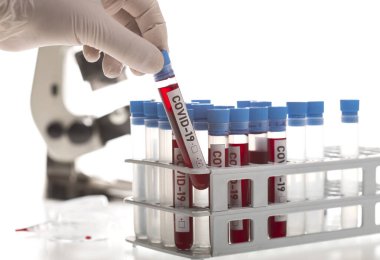Coronavirus tarafından kirletilmiş biyolojik bir tüp ile mikrobiyolog beyaz arka planda Covid-19 etiketiyle