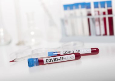 Coronavirus tarafından kirletilmiş biyolojik örnek tüpleri beyaz arka planda Covid-19 etiketi ile