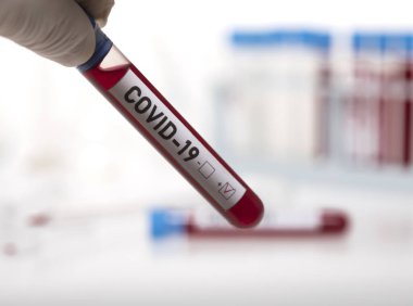 Coronavirus tarafından kirletilmiş biyolojik bir tüp ile mikrobiyolog beyaz arka planda Covid-19 etiketiyle