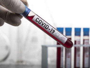 Coronavirus tarafından kirletilmiş biyolojik bir tüp ile mikrobiyolog beyaz arka planda Covid-19 etiketiyle