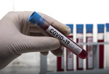 Coronavirus tarafından kirletilmiş biyolojik bir tüp ile mikrobiyolog beyaz arka planda Covid-19 etiketiyle