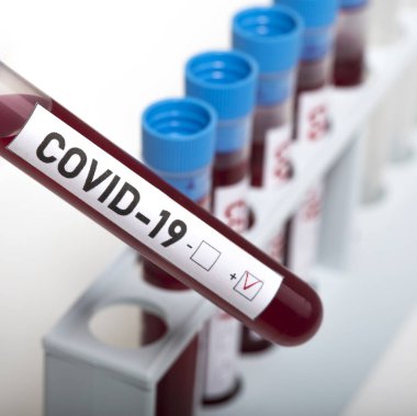 Coronavirus tarafından kirletilmiş biyolojik örnek tüpleri beyaz arka planda Covid-19 etiketi ile
