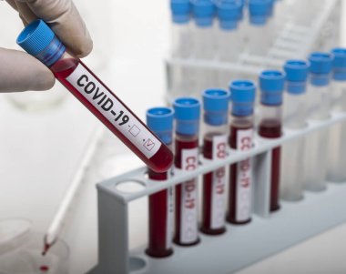 Coronavirus tarafından kirletilmiş biyolojik bir tüp ile mikrobiyolog beyaz arka planda Covid-19 etiketiyle