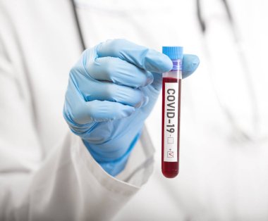 Coronavirus tarafından kirletilmiş biyolojik bir tüp ile mikrobiyolog beyaz arka planda Covid-19 etiketiyle