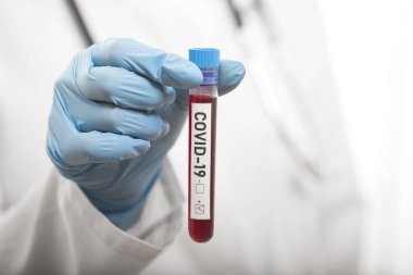 Coronavirus tarafından kirletilmiş biyolojik bir tüp ile mikrobiyolog beyaz arka planda Covid-19 etiketiyle