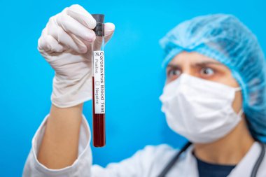 Solunum maskesi takan genç bir kadın doktor, Wuhan, Çin 'den gelen ve hızla yayılan yeni Coronavirüs için pozitif kan testi sonuçlarını tutuyor. Covid-19 test tüplü hemşire.