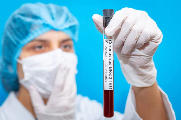 Young female doctor wearing respirator mask holding a positive blood test result for the new rapidly spreading worldwide Coronavirus, originating in Wuhan, China. Nurse with a Covid-19 test tube