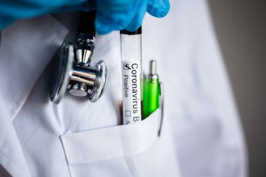 Coronavirus, bir doktorun beyaz önlüğünün cebinden kanla pozitif test tüpü çıkartılır. Covid 19 testi, steteskop başı ve yeşil kalem. No Cov2019 pandemia yardım. Tecrit karantinası