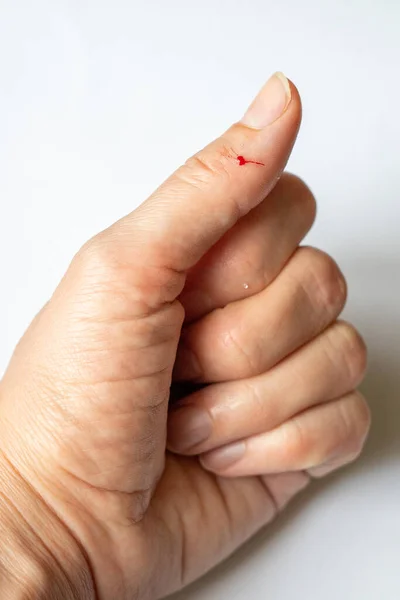 Finger His Hand Accidentally Wounded Knife — Stock Photo, Image