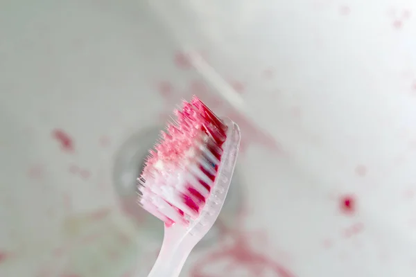Tandborste Med Blod Handfatet Och Tandkräm Blödande Tandkött Kopieringsutrymme Stängningsrör — Stockfoto