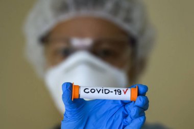 Korumalı giysili bir kadın test tüpü tutuyor. Analiz sonucu Coronavirus COVID 19-2019-nCoV enfeksiyonu kapmış.. 