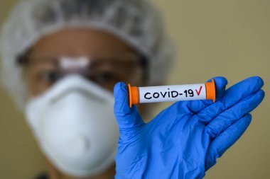Korumalı giysili bir kadın test tüpü tutuyor. Analiz sonucu Coronavirus COVID 19-2019-nCoV enfeksiyonu kapmış.. 