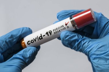 Mavi koruyucu eldivenler ve test tüpü. Sonuç pozitif çıktı. Koronavirüs COVID 19..