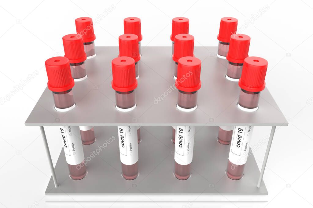 covid-19 nasal swab laboratory tests in rack. 3d illustration