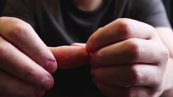 Close View Male Hands Strongly Bitten Nails Finger Selection Alarm — Stok video