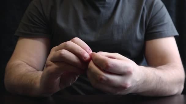 Close view of male hands with strongly bitten nails. Finger selection with alarm. Ugly bitten fingers, cuticles, wounds on the fingers. Bad habit. The concept of onychophagy and dermatophagy. — ストック動画