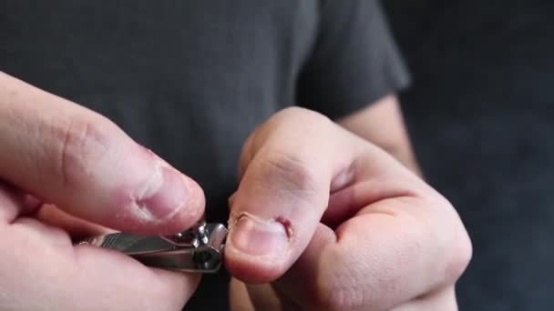 A man carefully cuts his nails with the help of tongs close-up. Adult chooses ugly nails. Bad habit of biting your fingers. Onychophagy and dermatophagy. Symptoms of Compulsive Obsessive Syndrome — Stockvideo
