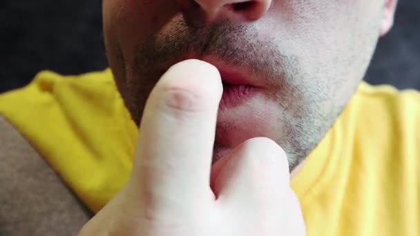 Lelijke Ugryzienie Vingers Bijtende Nagels Nagelriemen Wonden Aan Vingers Nagel — Stockvideo