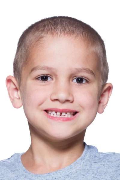 Dreng åbne sin mount for at vise de rene tænder - Stock-foto