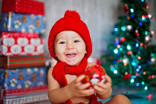 Sweet toddler boy with chickenpox, varicella zoster virus, with 