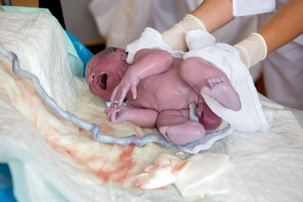 Yeni doğan bir bebek, doğumdan sonra ilk saniye — Stok fotoğraf