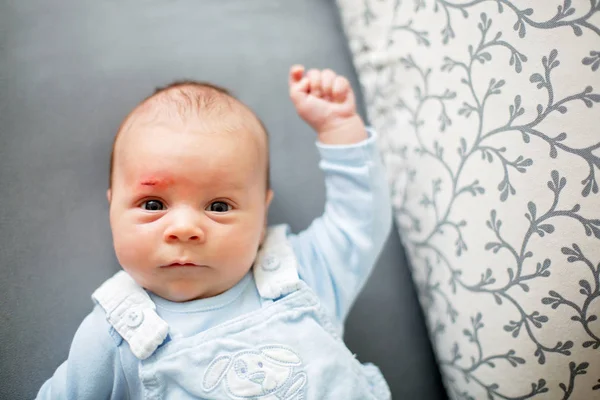 Little newborn baby with little wound on his forehead — Stock Photo, Image