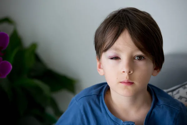 Triest Schooljongetje Met Blauw Oog Blauwe Plekken Kindermishandeling Verwondingen — Stockfoto