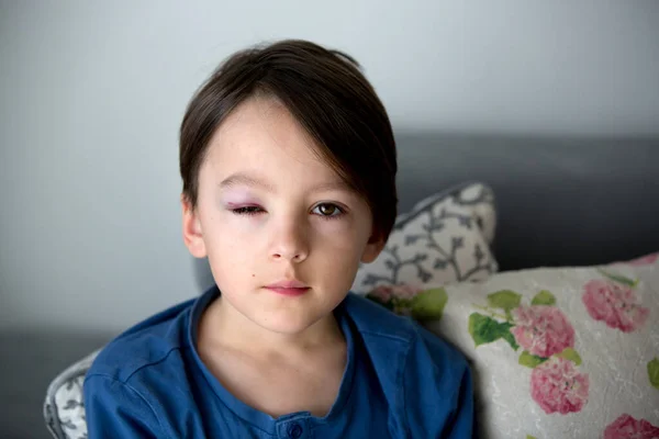 Triste Niño Escuela Con Ojo Morado Moretones Maltrato Infantil Lesiones — Foto de Stock