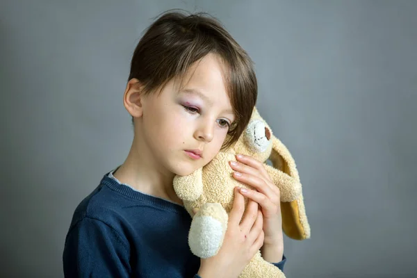 Szomorú Kis Iskolás Fiú Monoklival Véraláfutással Gyermekbántalmazással Sérüléssel — Stock Fotó